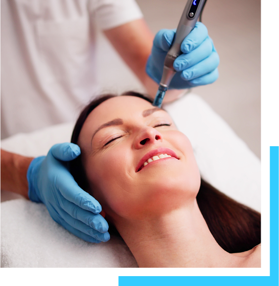 What is Microneedling? Banner